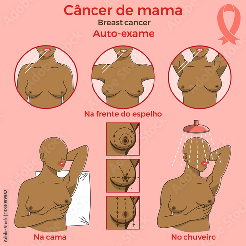 Self examination of breast cancer.  Medicine, pathology, anatomy, physiology, health. Vector illustration. Infographic.  Healthcare poster or banner template. Text in portuguese.