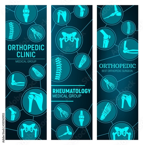 Orthopedics and rheumatology, joint diseases treatment. Human body joints x-ray, spine, knee and hip, pelvis, shoulder and foot, wrist, elbow vector. Orthopedic surgery, rheumatology clinic banner