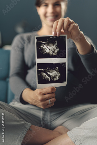 Happy pregnant woman showing ultrasound images of her baby photo