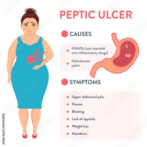 Peptic ulcer stomach disease infographic poster. Causes and symptoms of PUD. Digestive tract disorder. Female patient with abdominal pain. Health care and medical concept. Vector illustration. 