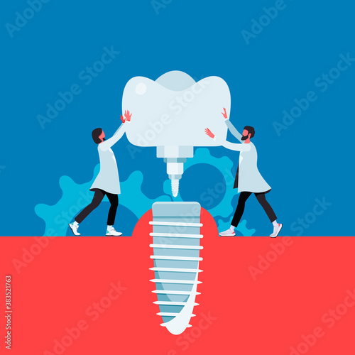 Dental implant flat cartoon illustration. Orthodontic banner design. Prostetic tooth background. Stomatology concept.