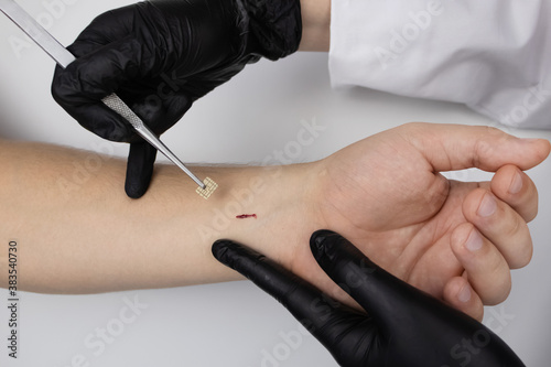 The cosmetic surgeon made a small incision to insert the chip into the patient s arm. Biotechnology  electronic documents and technological future concept