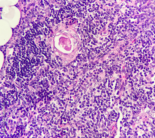 Foto Photo of involuted thymic tissue, magnification 400x