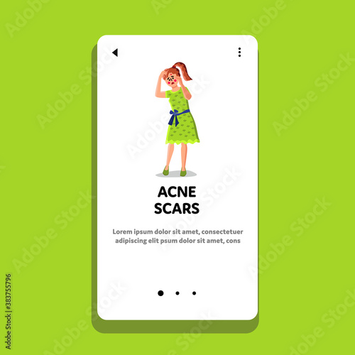 Facial Acne Scars Dermatology Skin Problem Vector