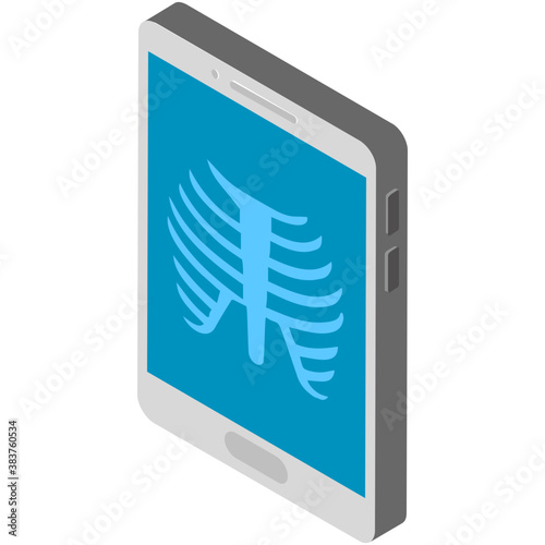 
Examination of human ribs by x ray
