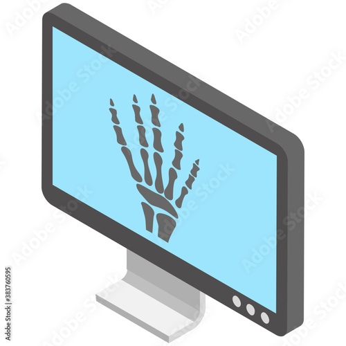 
A machine with hand x ray
