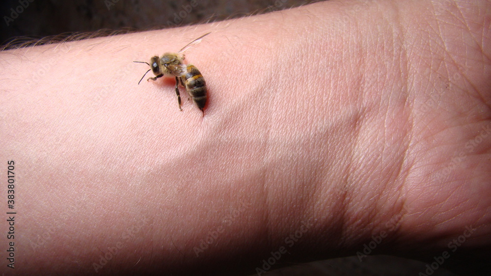 bee : apis mellifera treatment by honey bee sting closeup honey bee stinging a hand close up bee worker insects, insect, animal, wildlife, wild nature, forest, woods, garden beauty of pollination	