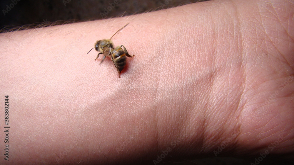 bee : apis mellifera treatment by honey bee sting closeup honey bee stinging a hand close up bee worker insects, insect, animal, wildlife, wild nature, forest, woods, garden beauty of pollination bee : apis mellifera treatment by honey bee sting closeup honey bee stinging a hand close up bee worker insects, insect, animal, wildlife, wild nature, forest, woods, garden beauty of pollination