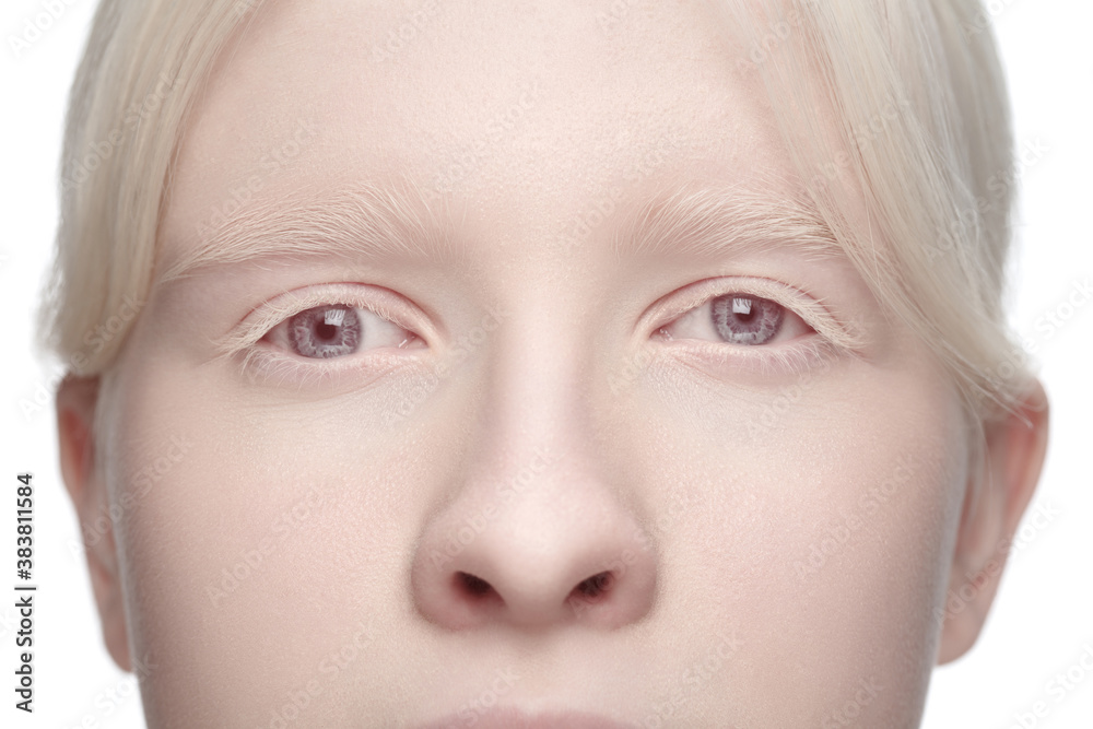 Eyes. Close up portrait of beautiful albino woman isolated on white studio background. Beauty, fashion, skincare, cosmetics concept. Copyspace. Well-kept skin, fresh look. Inclusion and diversity. Eyes. Close up portrait of beautiful albino woman isolated on white studio background. Beauty, fashion, skincare, cosmetics concept. Copyspace. Well-kept skin, fresh look. Inclusion and diversity.
