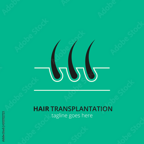 Hair transplantation logo concept for design. Vector healthcare medicine icon