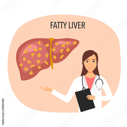 Fatty liver disease with doctor vector illustration. Human liver damage in flat design. Healthcare concept.