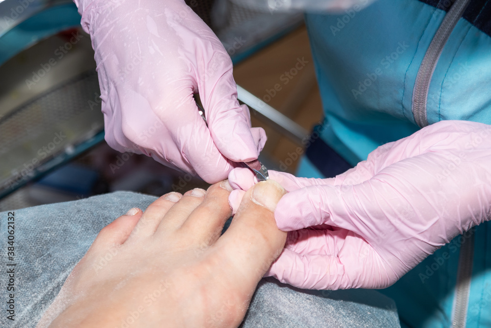 The pedicure process. The master cuts off the nail on the big toe with tongs.