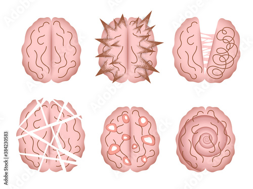 Mental disorder vector illustrations isolated. Abstract depictions of human brain altered by various mental illnesses, psychiatric disorders, neurological disorders or diseases.