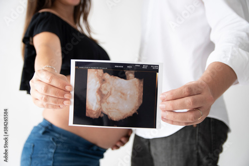 couple showing ultrasound of their baby photo