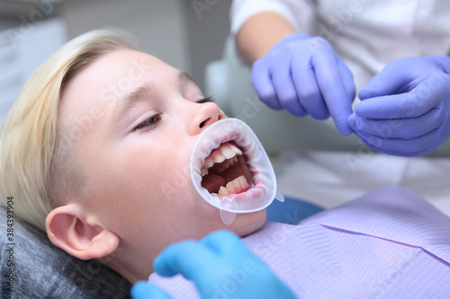 Tableau sur toile A dental retractor in a little boy's mouth