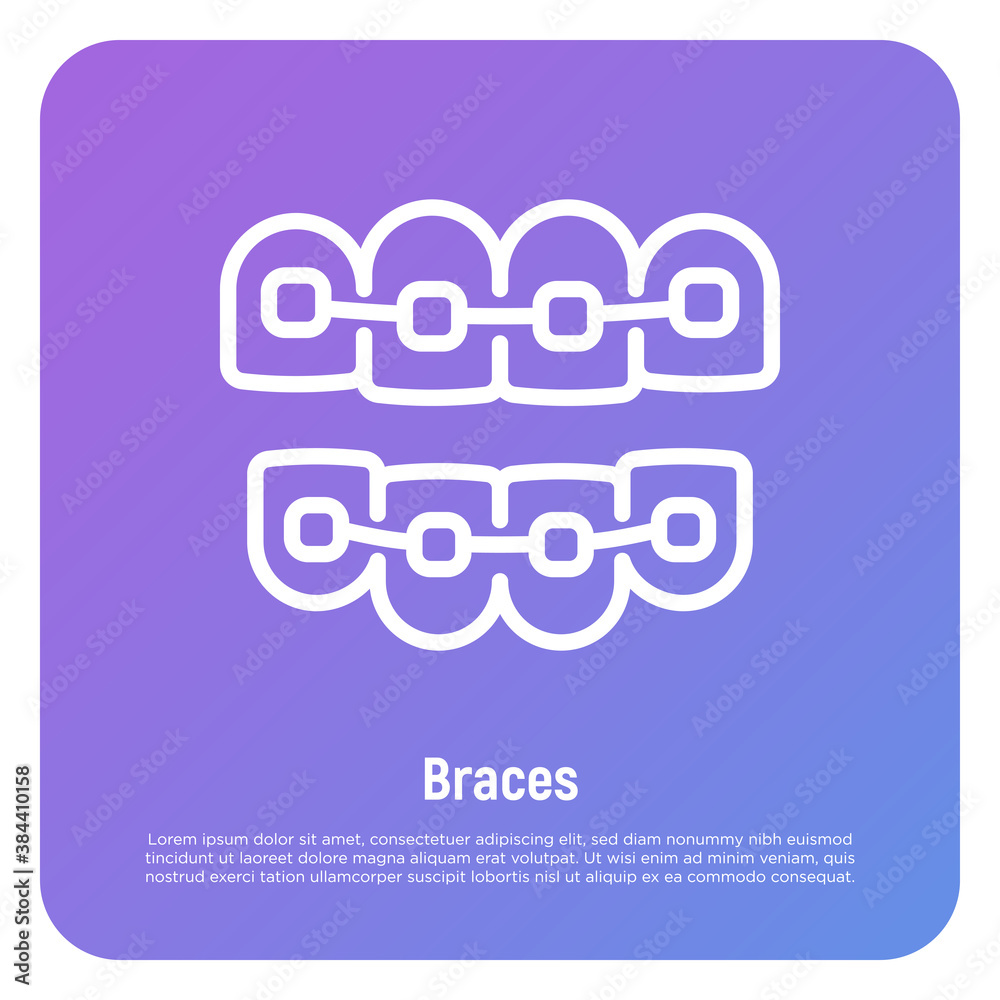 Orthodontics thin line icon. Braces, tooth correction. Dentistry. Vector illustration. Orthodontics thin line icon. Braces, tooth correction. Dentistry. Vector illustration.