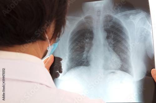 Female doctor carefully examines patient's lung X-ray