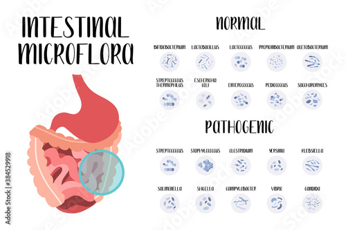 Intestinal microflora. Normal and pathogenic bacteria for stomach, gut, intestine. Good and bad microorganism. Microbiome. Vector flat cartoon illustration. Perfect for flyer, medical brochure, banner