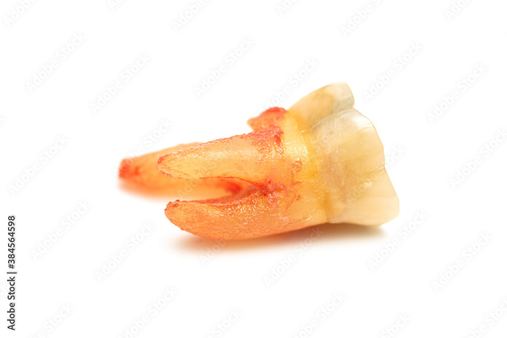 closed up of adult tooth number 14  after extraction isolated on white