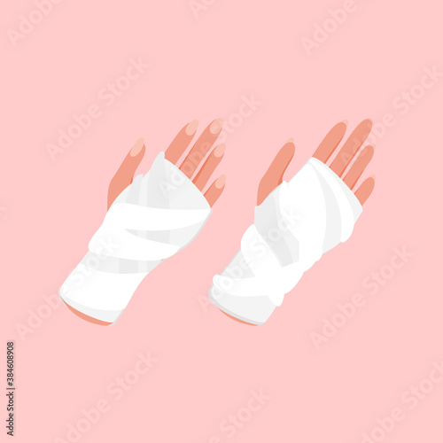 Broken arm, bone fracture, orthopedic plaster cast icon. Flat lay style. Vector illustration