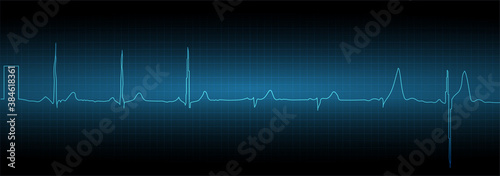 Sinus tachycardia. Heart rate graph. Ekg icon wave. Turquoise color. Stock vector illustration.