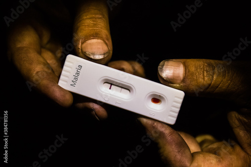 Dirty hands holding a positive malaria test in the dark photo