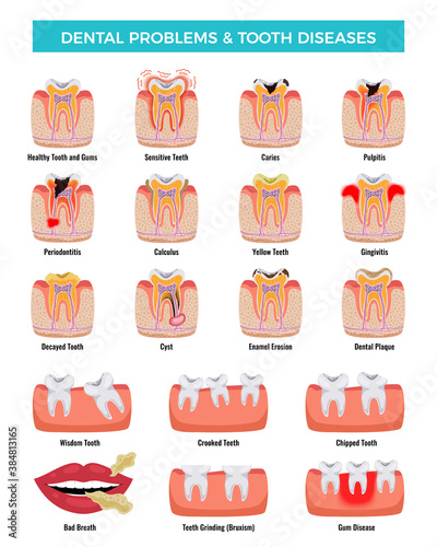 Dental Problems Diseases Infographic Set 