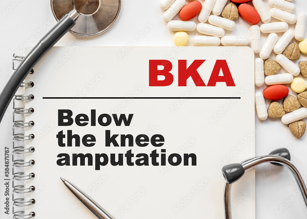 Page in notebook with BKA Below the knee amputation. on white