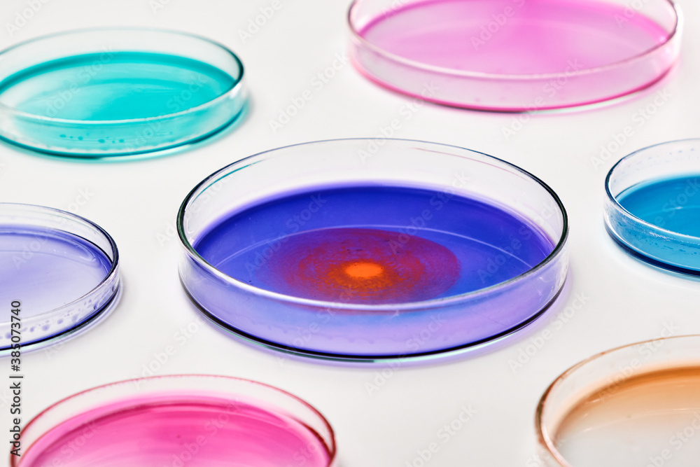 Colorful Petri dishes with media in a microbiology laboratory. Chemical research with different liquids. Development of vaccine and pharmaceuticals Colorful Petri dishes with media in a microbiology laboratory. Chemical research with different liquids. Development of vaccine and pharmaceuticals