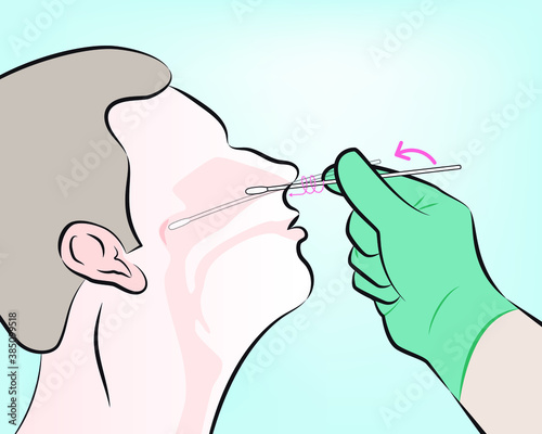 step 4 : Gently insert the swab into the nostril. Keep the swab near the septum floor of the nose while gently pushing the swab into the post nasopharynx.