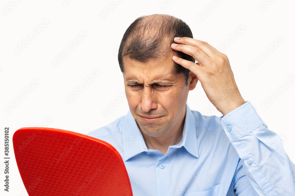Upset middle aged man with alopecia looking at mirror, hair loss concept Upset middle aged man with alopecia looking at mirror, hair loss concept