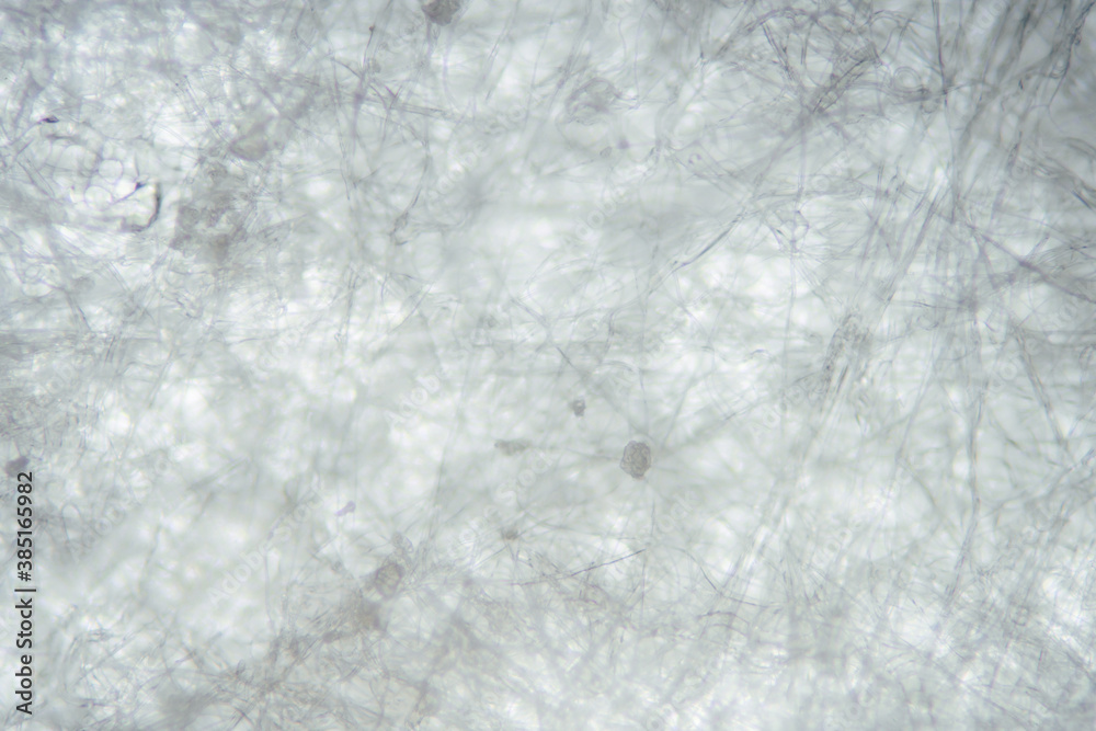 Particles are blocked by the meltblown cloth of the mask Particles are blocked by the meltblown cloth of the mask