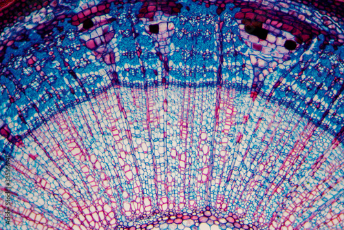 micrograph plant cells of woody dicot stem
