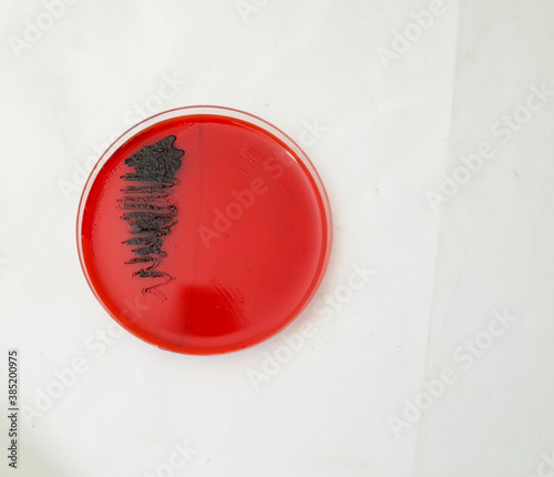 macro photo of Congo red agar test photo