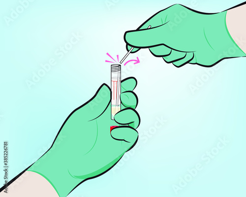 Step 7 : Identifying the scoreline, break the swab shaft against the side of the tube. If needed, gently rotate the swab shaft to complete the breakage. Discard the top portion of the swab shaft.