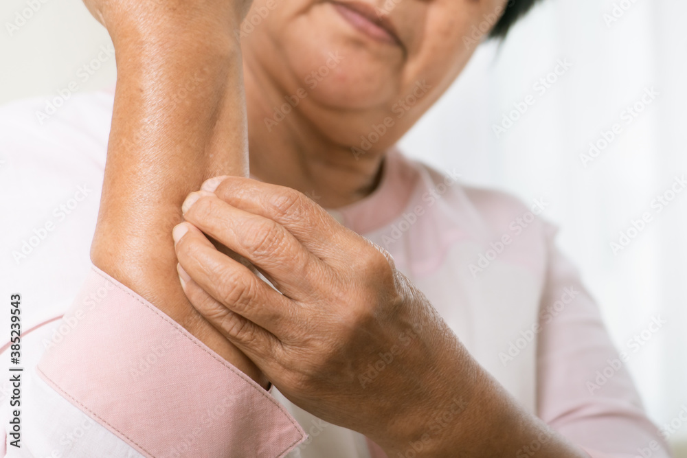 senior women scratch arm the itch on eczema arm, healthcare and medicine concept