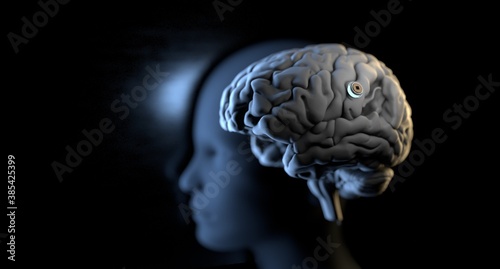 Neurotechnology, implantable brain machine, chip inserted into brain.