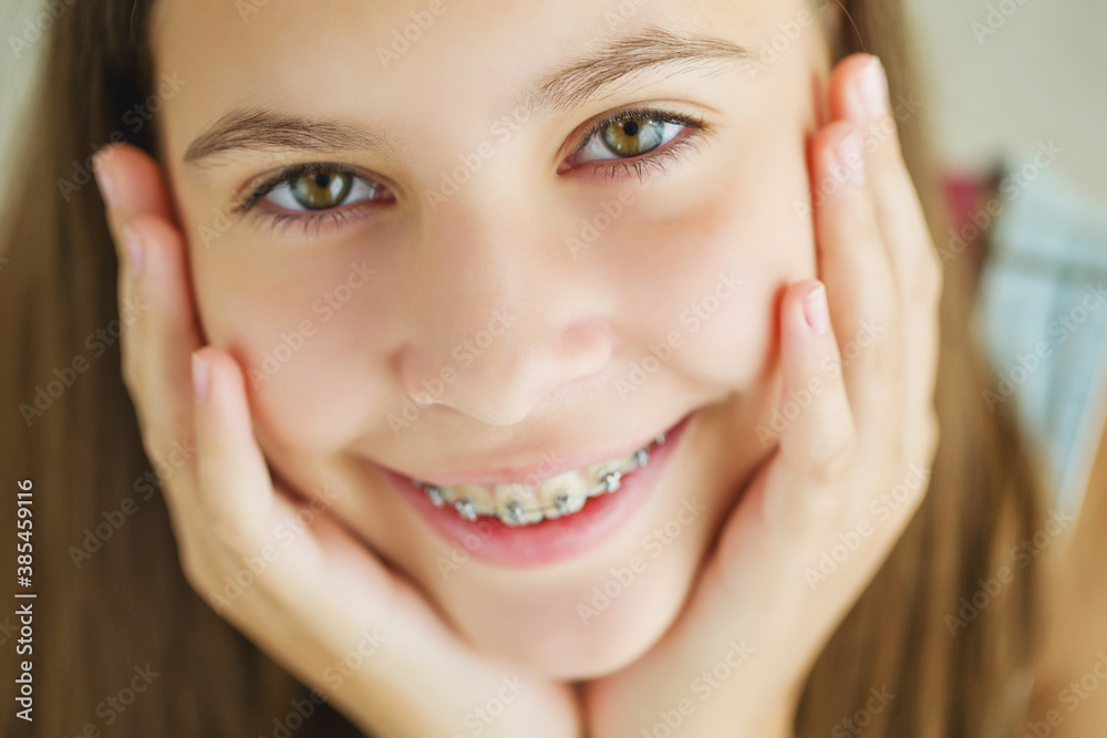 Close up portrait of smiling teenager girl showing dental braces.Isolated on white background. High quality photo. Close up portrait of smiling teenager girl showing dental braces.Isolated on white background. High quality photo.