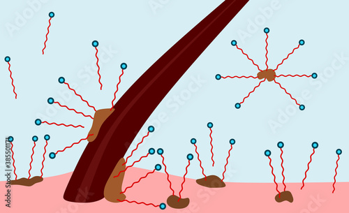 surfactant removing dirt soil particles from hair scape follicle, surface, surfactants, soap, solution, detergent, hydrophilic, hydrophobic, molecule, micelle, formation, Cross sectional view  photo