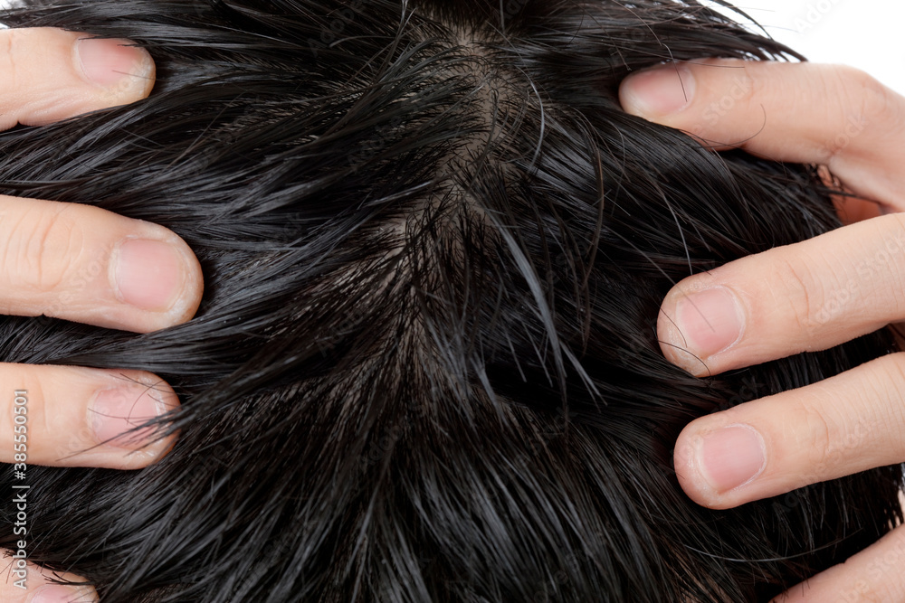 Obraz premium 頭皮