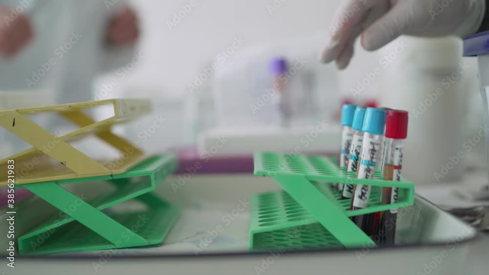 nurse arranges test tubes with blood on a tray. Doctor and medically test tubes with blood. nurse arranges test tubes with blood on a tray. Doctor and medically test tubes with blood.