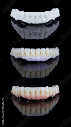 Three stages of making full dental cirkonium prosthesis on implants. Dental care concept.