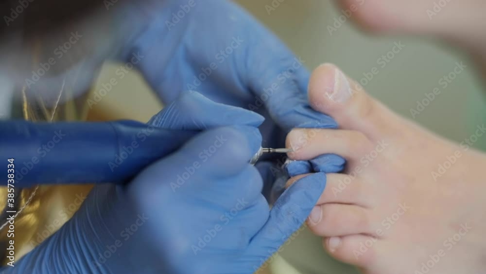 Hardware medical pedicure with nail file drill apparatus. Patient on