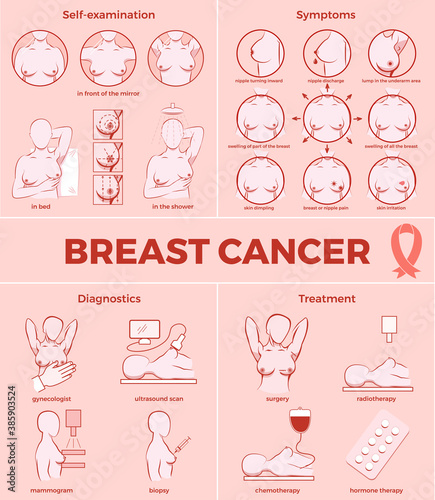 Breast cancer set. Self-examination, symptoms, diagnostics, treatments. Medicine, pathology, anatomy, physiology, health. Info-graphic. Vector illustration. Healthcare poster or banner template.