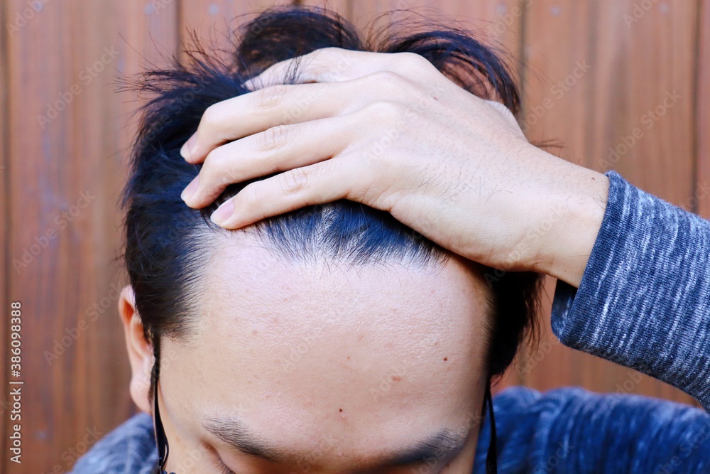 Fototapeta premium おでこの生え際を見せる日本人男性