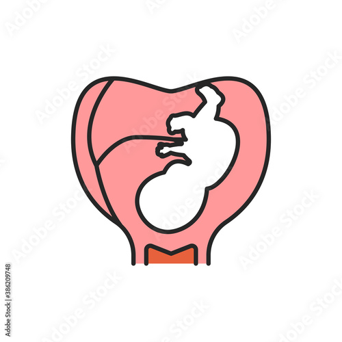 Pregnancy stage embryo in uterus with umbilical cord color line icon. Growth fetus development. Pictogram for web page, mobile app. UI UX GUI design element. Editable stroke.