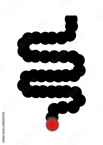 Intestine with hemorrhoid. Icon of hemorrhoids in bowel. Irritable pain in gut and rectal. Bacteria in stomach, bloating and fissure in anal. Logo of inflammation, oncology and hemorrhage. Vector