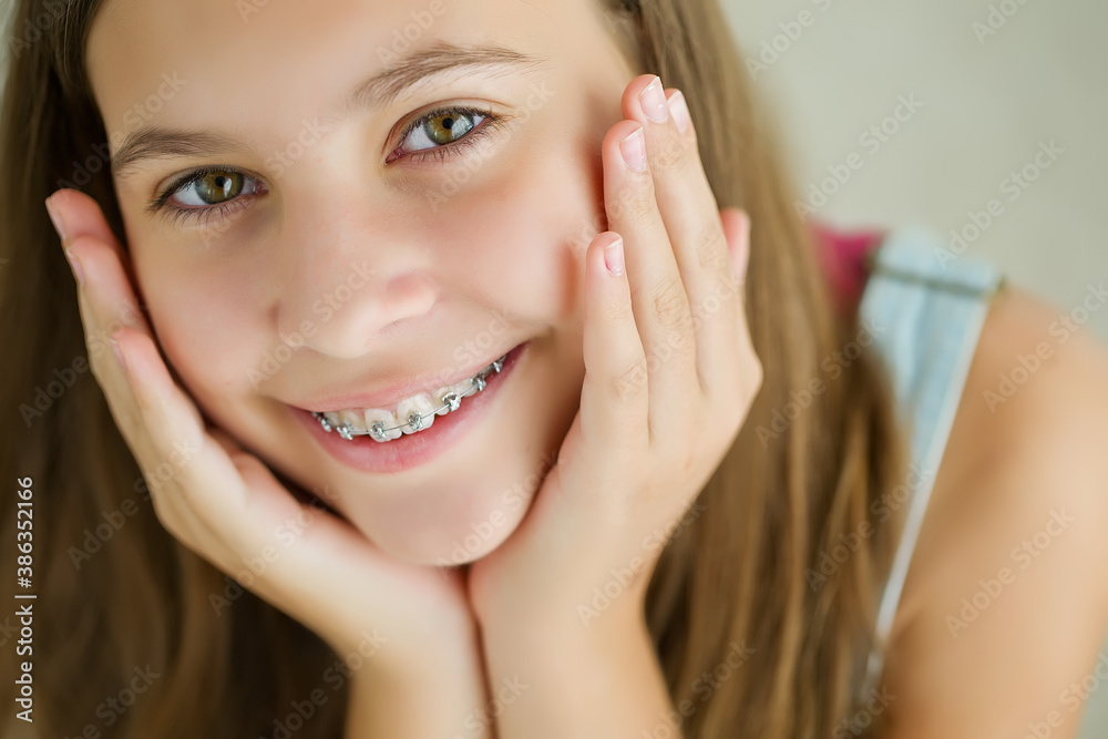 Close up portrait of smiling teenager girl showing dental braces.Isolated on white background. High quality photo. Close up portrait of smiling teenager girl showing dental braces.Isolated on white background. High quality photo.