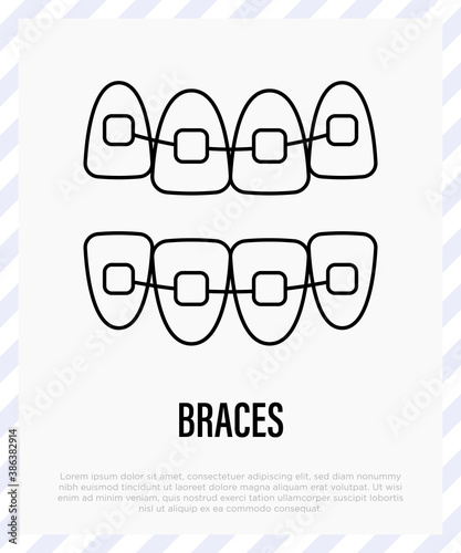 Orthodontics: braces, teeth correction. Dentistry. Thin line icon, vector illustration.