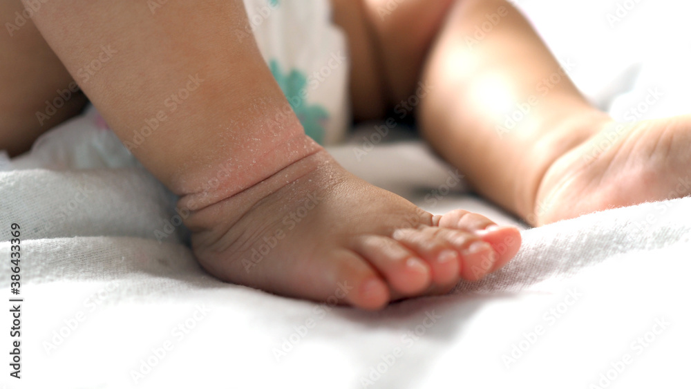 Close-up of the folds of the foot of a newborn baby with red skin ...